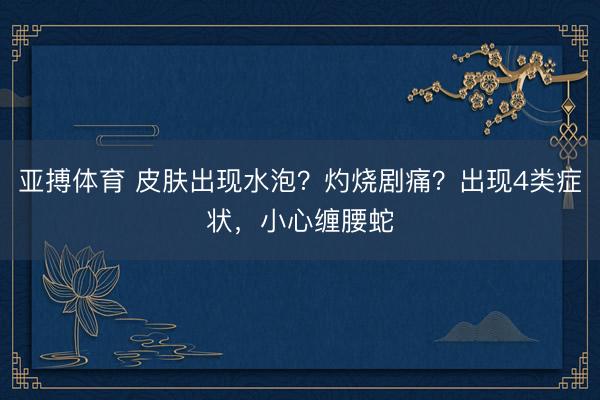 亚搏体育 皮肤出现水泡?灼烧剧痛?出现4类症状,小心缠腰蛇